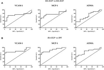 Elevated VCAM-1, MCP-1 and ADMA serum levels related to pulmonary fibrosis of interstitial lung disease associated with rheumatoid arthritis